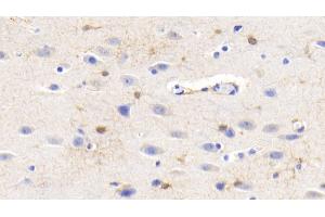 Detection of CK-BB in Human Cerebrum Tissue using Monoclonal Antibody to Creatine Kinase B (CK-BB) (CKB 抗体  (AA 11-367))