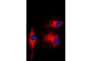 Immunofluorescent analysis of Gamma-enolase staining in K562 cells.