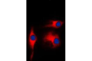 Immunofluorescent analysis of Gamma-enolase staining in K562 cells. (ENO2/NSE 抗体  (C-Term))