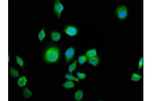 Immunofluorescence staining of A549 cells with ABIN7144052 at 1:100, counter-stained with DAPI. (ALS2CR12 抗体  (AA 26-76))