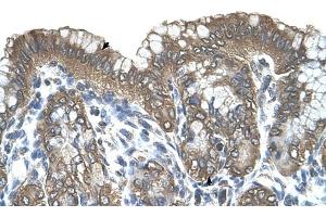 RARRES3 antibody was used for immunohistochemistry at a concentration of 4-8 ug/ml to stain Surface mucous cells and Epithelial cells of fundic gland (arrows) in Human Stomach. (RARRES3 抗体)