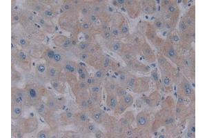 Detection of ASGR1 in Human Liver Tissue using Polyclonal Antibody to Asialoglycoprotein Receptor 1 (ASGR1) (Asialoglycoprotein Receptor 1 抗体  (AA 77-289))