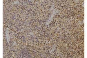 ABIN6259451 and ABIN6274942 at 1/100 staining Rat spleen tissue by IHC-P. (ARPP21 抗体  (Internal Region))