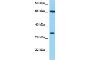 WB Suggested Anti-HLA-C Antibody Titration: 1. (HLA-C 抗体  (C-Term))