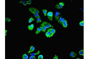 Immunofluorescence (IF) image for anti-LPS-Responsive Vesicle Trafficking, Beach and Anchor Containing (LRBA) (AA 2-252) antibody (ABIN7158439)