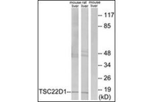 Western blot analysis of extracts from mouse liver/rat liver cells, using TSC22D1 Antibody . (TSC22D1 抗体  (N-Term))