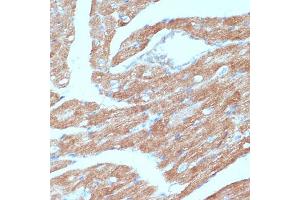 Immunohistochemistry of paraffin-embedded mouse heart using  antibody (ABIN6129863, ABIN6136456, ABIN6136457 and ABIN6215371) at dilution of 1:100 (40x lens).