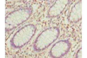Immunohistochemistry of paraffin-embedded human testis tissue using ABIN7155301 at dilution of 1: 100 (HDAC1 抗体  (AA 1-482))