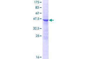 Ankyrin Repeat Domain 7 (ANKRD7) (AA 1-201) protein (GST tag)