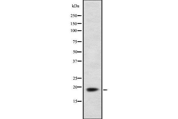 Ferredoxin1 (FDX1) (Internal Region) 抗体