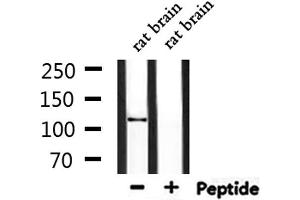Western blot analysis of extracts from rat brain, using CEP110 Antibody. (Centriolin 抗体)