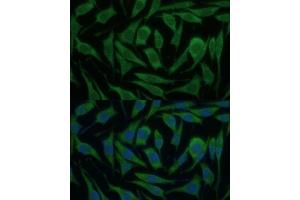 Immunofluorescence (IF) image for anti-Kinesin Family Member 14 (KIF14) (AA 1399-1648) antibody (ABIN6142854)