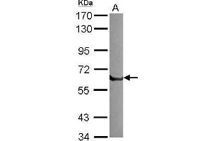 Western Blotting (WB) image for anti-Plasminogen Activator, Tissue (PLAT) antibody (ABIN2855635)