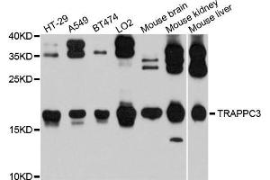 Western blot analysis of extracts of various cells, using TRAPPC3 antibody. (TRAPPC3 抗体)