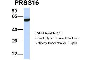 Host:  Rabbit  Target Name:  PRSS16  Sample Type:  Human Fetal Liver  Antibody Dilution:  1. (PRSS16 抗体  (Middle Region))