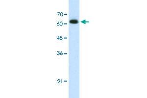 Western Blot analysis of Jurkat cell lysate with DIS3L2 polyclonal antibody  at 1. (DIS3L2 抗体  (N-Term))