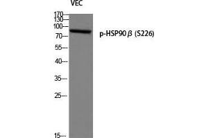 Western Blot (WB) analysis of VEC using p-HSP90beta (S226) antibody.