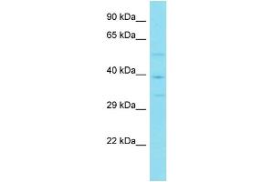 Western Blotting (WB) image for anti-Von Willebrand Factor C Domain Containing 2 (VWC2) (Middle Region) antibody (ABIN2790885)