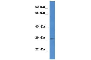 Western Blotting (WB) image for anti-SplA/ryanodine Receptor Domain and SOCS Box Containing 2 (SPSB2) (C-Term) antibody (ABIN926548)