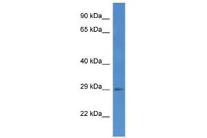 Western Blot showing SPSB2 antibody used at a concentration of 1 ug/ml against COLO205 Cell Lysate (SPSB2 抗体  (C-Term))