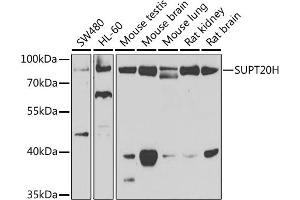 Western blot analysis of extracts of various cell lines, using SUPT20H antibody (ABIN6133386, ABIN6148735, ABIN6148736 and ABIN6223233) at 1:1000 dilution. (FAM48A/P38IP 抗体  (AA 580-779))