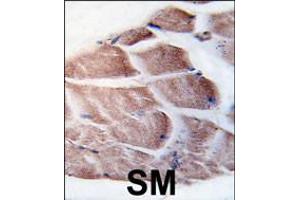 Formalin-fixed and paraffin-embedded human skeletal muscle tissue reacted with RSK3 antibody , which was peroxidase-conjugated to the secondary antibody, followed by DAB staining.