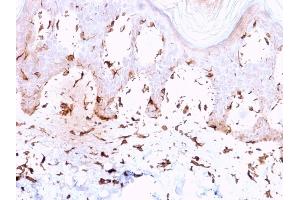 Formalin-fixed, paraffin-embedded human Skin stained with Collagen VII Mouse Monoclonal Antibody (LH7.