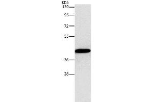 Western Blot analysis of MCF7 cell using Connexin-45 Polyclonal Antibody at dilution of 1:1250 (GJC1 抗体)