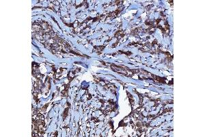 IHC analysis of GPCR RDC1/CXCR-7/ACKR3 using anti-GPCR RDC1/CXCR-7/ACKR3 antibody (ABIN7602889). (CXCR7 抗体  (C-Term))