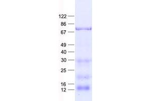 Nucleostemin Protein (His tag)