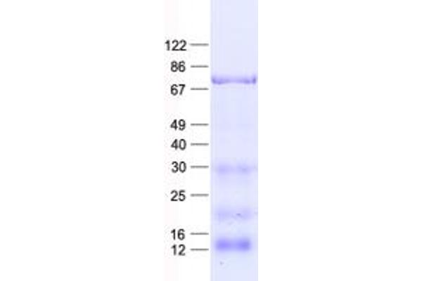 Nucleostemin Protein (His tag)