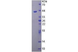 SDS-PAGE analysis of Human ARTN Protein. (ARTN 蛋白)