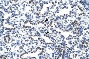 Image no. 1 for anti-Nucleophosmin (Nucleolar phosphoprotein B23, Numatrin) (NPM1) (N-Term) antibody (ABIN202181) (NPM1 抗体  (N-Term))