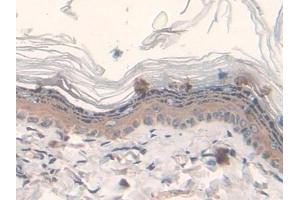 Detection of FASN in Rat Skin Tissue using Polyclonal Antibody to Fatty Acid Synthase (FASN) (Fatty Acid Synthase 抗体  (AA 2243-2505))
