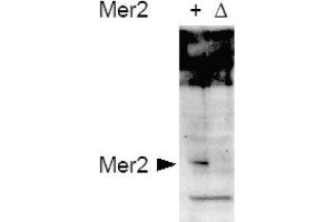 Image no. 1 for anti-CD151 (CD151) (AA 26-35), (pSer30) antibody (ABIN401337) (CD151 抗体  (pSer30))