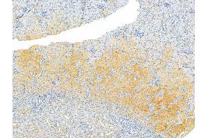 ABIN6264259 and ABIN6273065 at 1/100 staining Rat kidney tissue by IHC-P. (PKLR 抗体  (Internal Region))