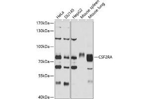 Western blot analysis of extracts of various cell lines, using CSF2RA antibody (ABIN3022748, ABIN3022749, ABIN1512778 and ABIN6219208) at 1:1000 dilution. (CSF2RA 抗体  (AA 23-320))