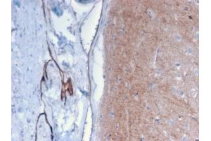 Formalin-fixed, paraffin-embedded human Brain stained with Drebrin-1 Mouse Monoclonal Antibody (DBN1/2879). (DBN1 抗体  (AA 150-281))