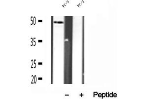 Western blot analysis of extracts of PC-3 cells, using SUCLA2 antibody. (SUCLA2 抗体  (Internal Region))