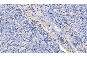 Immunohistochemistry (IHC) image for anti-Cyclin-Dependent Kinase 1 (CDK1) (AA 59-182) antibody (ABIN7434281)