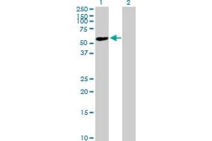 Western Blot analysis of ZNF565 expression in transfected 293T cell line by ZNF565 MaxPab polyclonal antibody. (ZNF565 抗体  (AA 1-499))