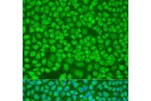 Immunofluorescence analysis of U2OS cells using PNKD Polyclonal Antibody at dilution of 1:100. (PNKD 抗体)