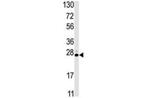 Western blot analysis of STK19 antibody and HL-60 lysate. (STK19 抗体  (AA 278-308))