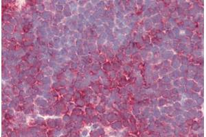 Human Thymus (formalin-fixed, paraffin-embedded) stained with PSENEN antibody ABIN461899 at 5 ug/ml followed by biotinylated goat anti-rabbit IgG secondary antibody ABIN481713, alkaline phosphatase-streptavidin and chromogen. (PEN2 抗体  (N-Term))