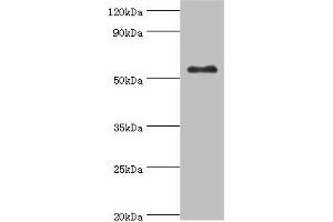 Western blot All lanes: Glucokinase antibody at 8 μg/mL + HepG2 whole cell lysate Secondary Goat polyclonal to rabbit IgG at 1/10000 dilution Predicted band size: 52 kDa Observed band size: 52 kDa (GCK 抗体  (AA 1-300))