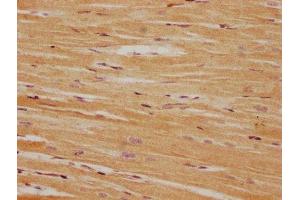 IHC image of ABIN7165960 diluted at 1:100 and staining in paraffin-embedded human heart tissue performed on a Leica BondTM system. (PPM1L 抗体  (AA 128-343))
