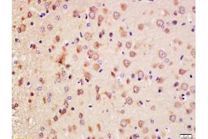 Formalin-fixed and paraffin embedded rat brain labeled with Anti-Erbin Polyclonal Antibody, Unconjugated  at 1:200 followed by conjugation to the secondary antibody and DAB staining. (ERBB2IP 抗体  (AA 21-120))