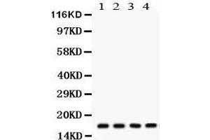 Western Blotting (WB) image for anti-Stathmin 1 (STMN1) (AA 2-34), (N-Term) antibody (ABIN3043301) (Stathmin 1 抗体  (N-Term))