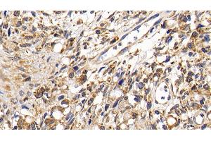 Immunohistochemistry (IHC) image for anti-Cathepsin K (CTSK) (AA 54-317) antibody (ABIN7441856)