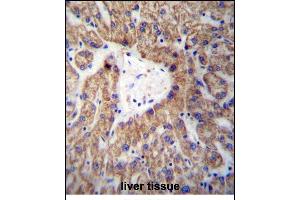 GLYAT Antibody (Center) (ABIN656988 and ABIN2846171) immunohistochemistry analysis in formalin fixed and paraffin embedded human liver tissue followed by peroxidase conjugation of the secondary antibody and DAB staining. (GLYAT 抗体  (AA 171-199))